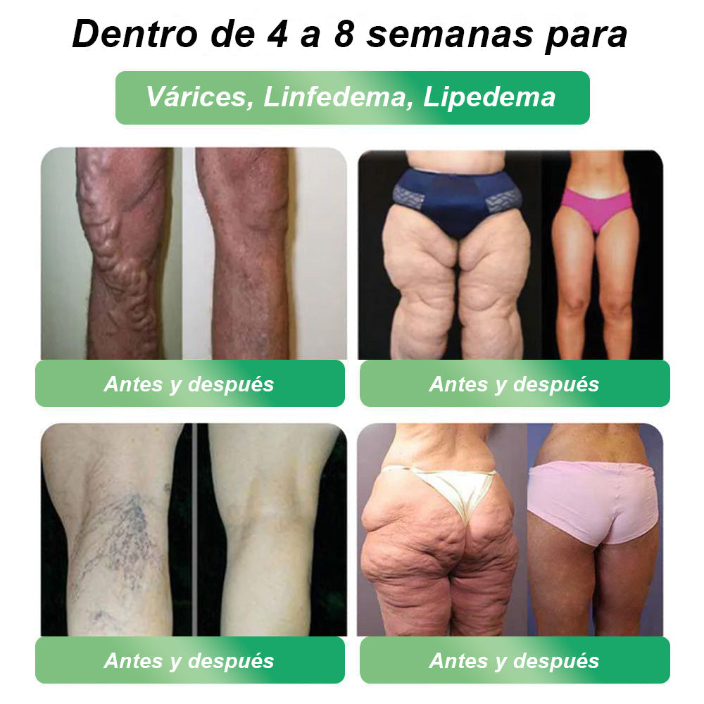 Tienda Oficial 𝐂𝐕𝐑𝐄𝐎𝐙® GLP-1 Seis en Uno Solución Oral para la Salud (Solo una vez al día, cambios visibles en 7 días) Para la obesidad, salud cardiovascular, diabetes, apnea del sueño, salud intestinal, problemas articulares y más.